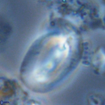 Helicosphaera kamptneri VR 05657