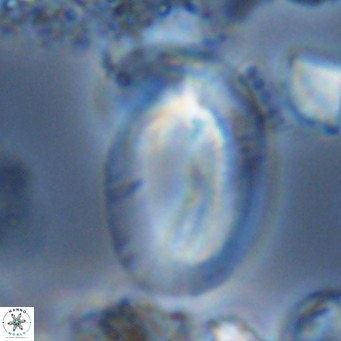 Helicosphaera kamptneri VR 05658