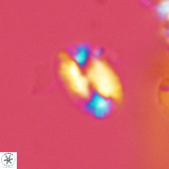Helicosphaera kamptneri VR 05779