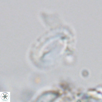 Helicosphaera kamptneri VR 05783