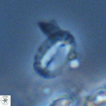 Helicosphaera kamptneri VR 05790