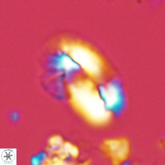Helicosphaera kamptneri VR 05949