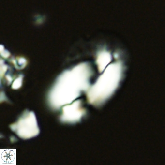 Helicosphaera kamptneri VR 05952
