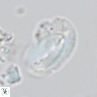 Helicosphaera kamptneri VR 05954