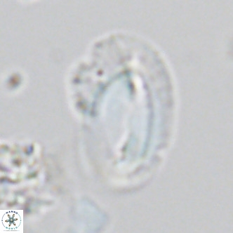 Helicosphaera kamptneri VR 05956