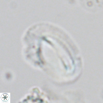 Helicosphaera kamptneri VR 05958