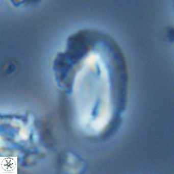 Helicosphaera kamptneri VR 05960