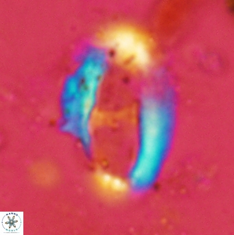 Helicosphaera leesiae 2384