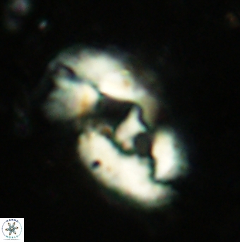 Helicosphaera leesiae 2454