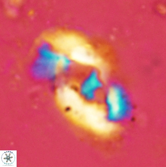 Helicosphaera leesiae 2455