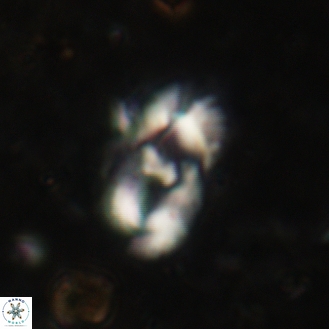 Helicosphaera leesiae 35