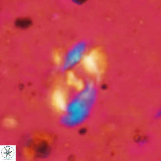 Helicosphaera leesiae 36