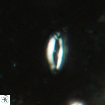 Helicosphaera lenticulata 2308