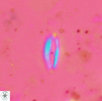 Helicosphaera lenticulata 2309