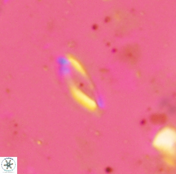 Helicosphaera lenticulata 2310
