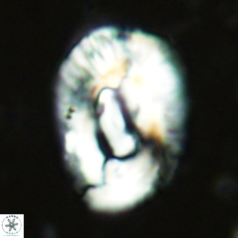 Helicosphaera lophota VR 02501