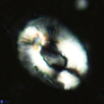 Helicosphaera lophota VR 02502