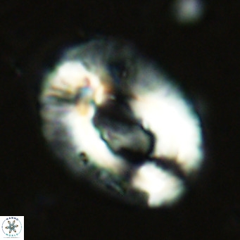 Helicosphaera lophota VR 02502
