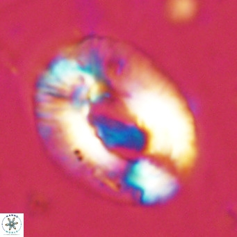 Helicosphaera lophota VR 02503