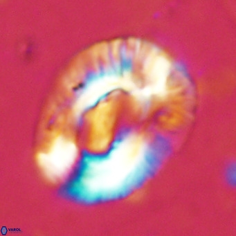 Helicosphaera lophota VR 02504