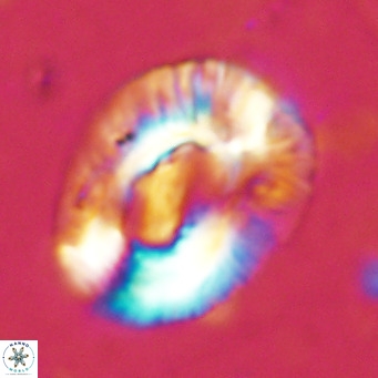 Helicosphaera lophota VR 02504