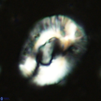 Helicosphaera lophota VR 02505