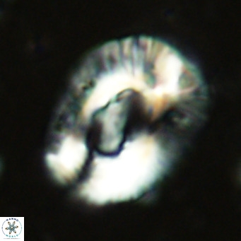 Helicosphaera lophota VR 02505