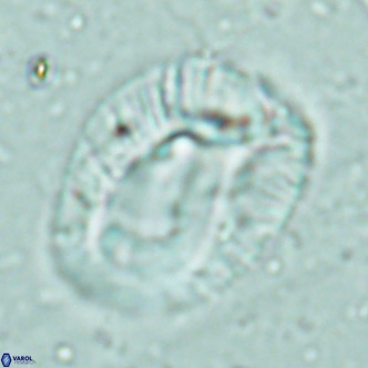 Helicosphaera lophota VR 02506