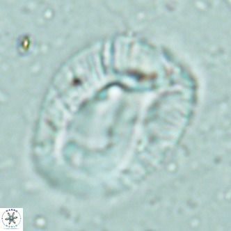 Helicosphaera lophota VR 02506