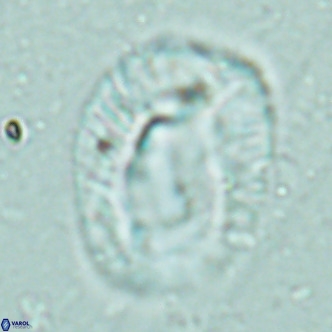 Helicosphaera lophota VR 02507