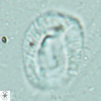 Helicosphaera lophota VR 02507