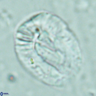 Helicosphaera lophota VR 02508