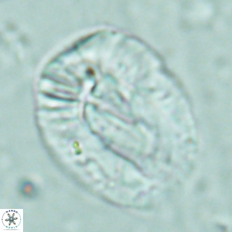 Helicosphaera lophota VR 02508