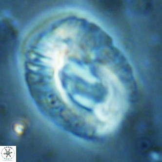 Helicosphaera lophota VR 02509