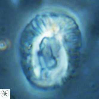 Helicosphaera lophota VR 02510
