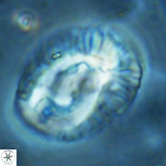Helicosphaera lophota VR 02511
