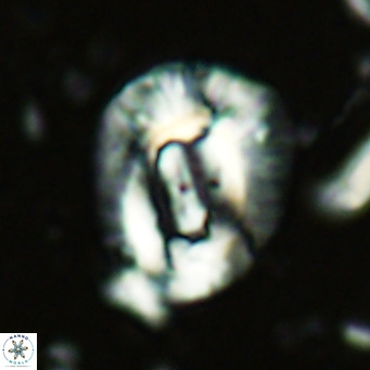 Helicosphaera lophota VR 02827