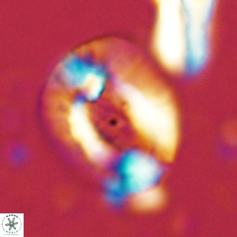 Helicosphaera lophota VR 02829