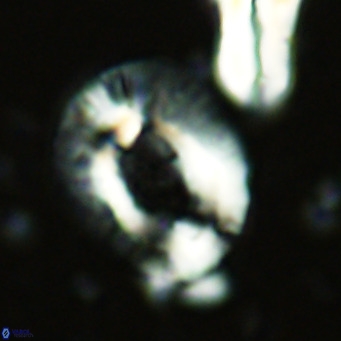 Helicosphaera lophota VR 02830