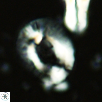 Helicosphaera lophota VR 02830
