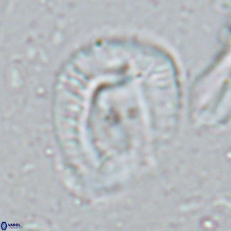 Helicosphaera lophota VR 02833