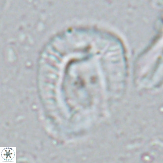 Helicosphaera lophota VR 02833