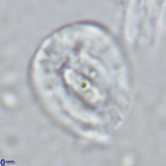 Helicosphaera lophota VR 02834