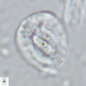 Helicosphaera lophota VR 02834