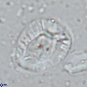 Helicosphaera lophota VR 02835