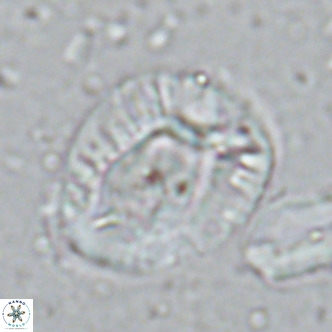 Helicosphaera lophota VR 02835