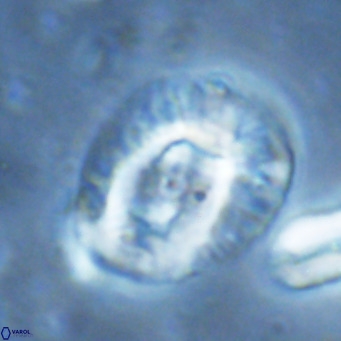 Helicosphaera lophota VR 02836