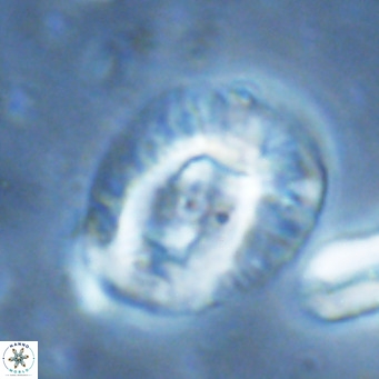 Helicosphaera lophota VR 02836