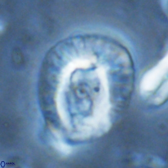 Helicosphaera lophota VR 02837