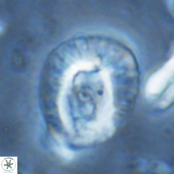 Helicosphaera lophota VR 02837